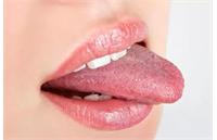 هشدار پزشکان درباره تتوی زبان برای ایجاد رنگ قرمز دائمی