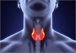 همه چیز درباره بیماری تیروئید