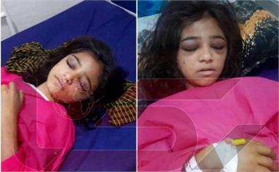 پرونده شکنجه دختر ۱۰ ساله بلوچ