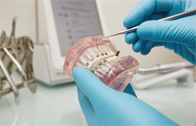 توصیه‌های ضروری متخصص ارتودنسی برای جلوگیری از مشکلات دندان و فک