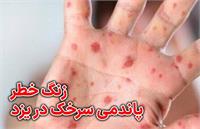 شناسایی سه مورد ابتلا به سرخک در یزد