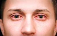 آمار «بیماری کشنده» قارچ سیاه مخفی مانده است/نماینده مجلس گفت علت مرگ بیماران را در گواهی فوت نمی نویسند!