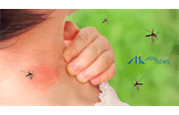 نیش و خارش؛ دردسرهای تابستانی و راه‌های پیشگیری آن